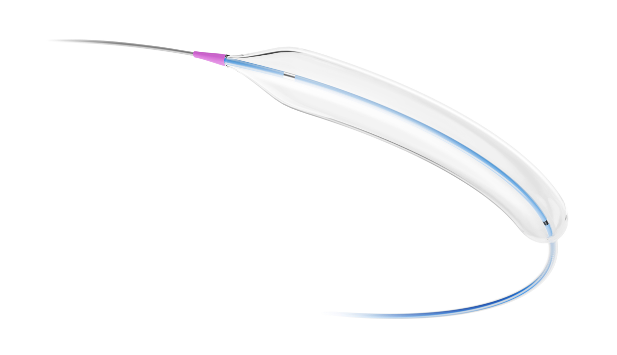 Gambit-Nc 2.0-4.0mm